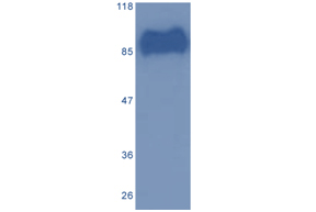 Figure: MA23 (0.001µg/ml) staining of Hep3B cell lysate (5µg protein in RIPA buffer). Primary incubation at 4℃ overnight, detection by chemiluminescence.